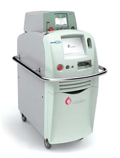 リフトアップレーザー