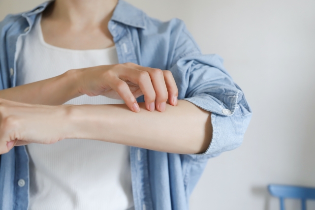 じんましん（蕁麻疹）